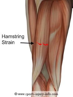 Pull Hamstring