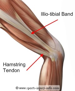 Tendons are similar to ligaments; Origins Of Thigh Tendons : PMR symptom/anyone get this? - Autoimmune diseases - Inspire