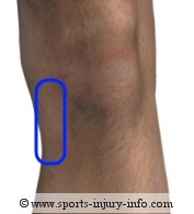 Knee Pain - MCL Injury