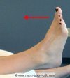 Ankle Dorsiflexion