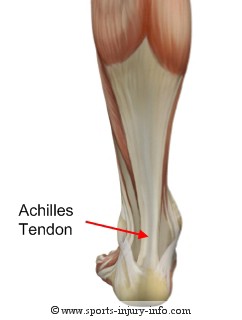 Achilles Tendon