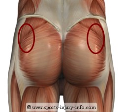 Painful Areas - Piriformis Syndrome10