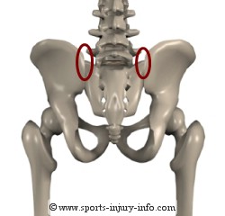 Hip Pain - SI Joint