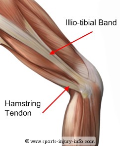Illiotibial Band - Sports Injury Info