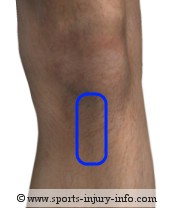 Knee Pain - Patellar Tendonitis