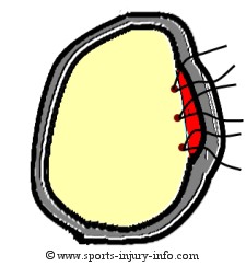 Labral Repair Sutures