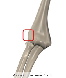 Lateral Epicondyle - Sports Injury Info