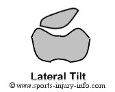 Lateral Patellar Tilt