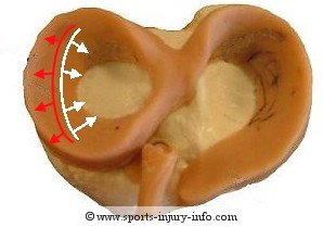 Zones of Repair