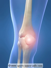 PCL Knee Injury