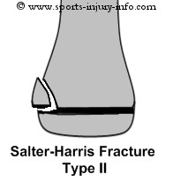 Salter Harris II