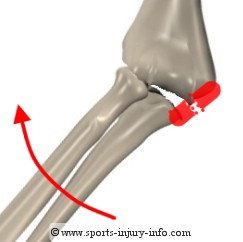 Ulnar Collateral Ligament Sprain