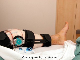 Post Operative Brace Sports Injury Info