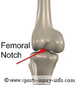 Femoral Notch