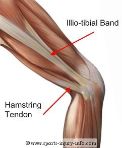 Illiotibial Band - Sports Injury Info