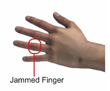 Jammed Finger Pain - Sports Injury Info
