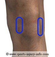Area of Knee Pain