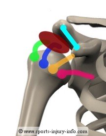 Subacromial Decompression