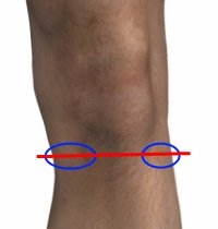 Meniscus Tear Pain - Sports Injury Info